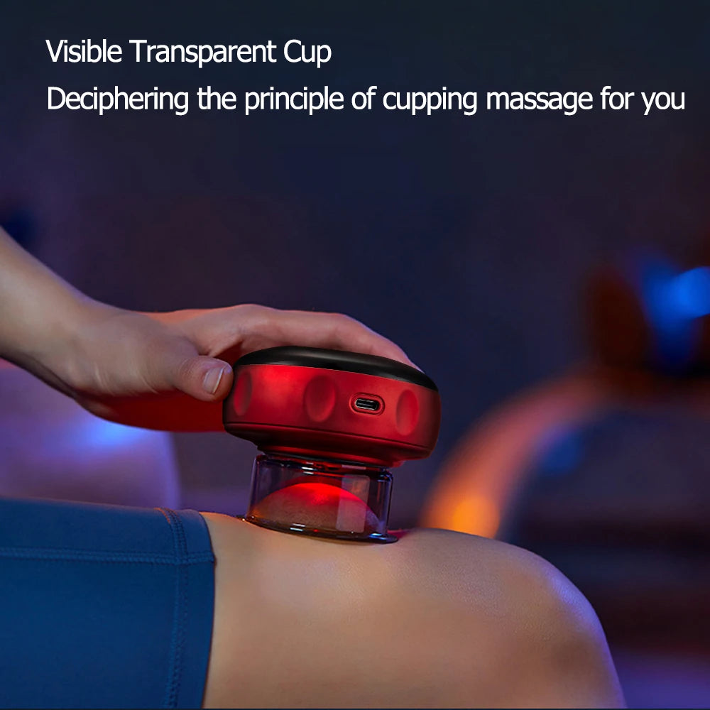 Electric Vacuum Cupping Massager – Anti-Cellulite Therapy & Fat-Burning Slimming Device